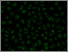 [thumbnail of DLKPA_2microM_epirubicin_100_microM_Verapamil_.tif	]