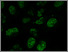 [thumbnail of DLKPA_2microM_epirubicin_10_microM_Cyclosporin_A_Zm.tif]