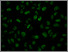 [thumbnail of DLKPA_2microM_epirubicin_10_microM_Cyclosporin_A.tif]