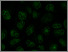[thumbnail of DLKPA_2microM_epirubicin_100_microM_Verapamil_Zm.tif]